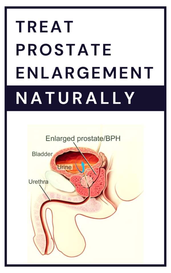 Treat Prostate Enlargement Naturally